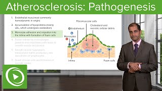 Atherosclerosis Pathogenesis amp SupplyDemand Mismatch – Cardiovascular Pathology  Lecturio [upl. by Tnek446]