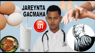 GARIIRKA GACMAHA AMA JAREYNTA GACMAHA  ESSENTIAL TREMOR [upl. by Enrika]