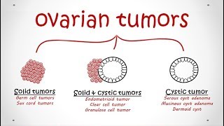 Ovarian Tumors All types Pathology [upl. by Anyalram974]