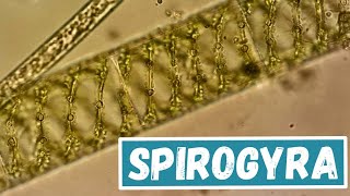 Spirogyra Under The Microscope [upl. by Katzir878]