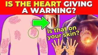 ALERT 10 SIGNS on the SKIN and NAILS of SERIOUS HEART PROBLEMS [upl. by Fernandina445]