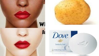 UNBELIEVABLE SKIN WHITENING WITH POTATO AND DOVE SOAP AT HOME [upl. by Aroved]