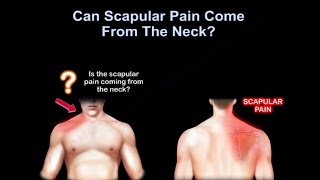 Neck pain or shoulder pain WHY IT HURTS [upl. by Altman]