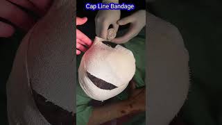 Head Bandage Or Cap Line Bandage bandage [upl. by Eelek]