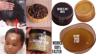 MIX CLOVE amp INDIAN HEMP TO GROW BACK BALDNESS ALOPECIA SHEDDING 3 TIMES UNSTOPPABLE FASTER [upl. by Dloniger]