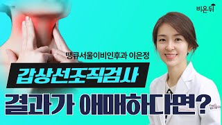 갑상선조직검사 결과가 애매하다면땡큐서울이비인후과 이은정 원장 [upl. by Nuahsor]