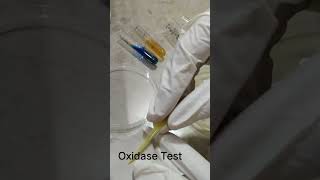 Oxidase test [upl. by Lesab]