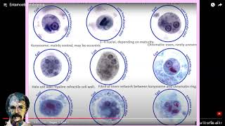 Diagnostic Parasitology Entamoeba histolyticaCourse [upl. by Bessie]