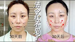 30天挑战我测评过最好用的美容仪，30天后效果我都惊呆了｜30 Days Of Using Amiro Facial Device Results Are Shocking【Amiro】 [upl. by Charil]