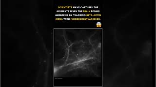 Memory Formation RealTime Tracking of BetaActin mRNA  The Doctorpreneur Academy [upl. by Athalee]