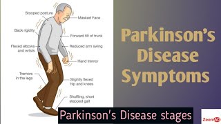 Clinical Presentation Of Parkinson DiseaseStages Of Parkinson DiseaseParkinsons Disease Symptoms [upl. by Tessi]