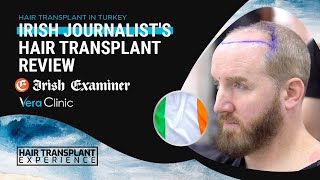 Irish Journalists Hair Transplant Journey at Vera Clinic hairtransplant hairtransplantturkey [upl. by Anneres295]