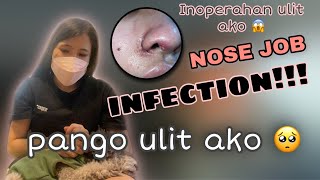 RHINOPLASTY INFECTION 😭😭  NOSE JOB PHILIPPINES [upl. by Inhoj826]