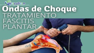 ONDAS DE CHOQUE  TRATAMIENTO FASCITIS PLANTAR con ESPOLON CALCANEO Fisioterapia  Fisiolution [upl. by Ayin]