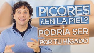 ¿PICORES POR EL CUERPO La causa podría estar en tu hígado [upl. by Felipa]