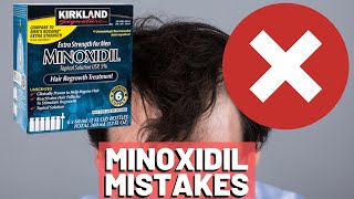 5 BIGGEST MISTAKES When Using Minoxidil REVEALED [upl. by Sadira]