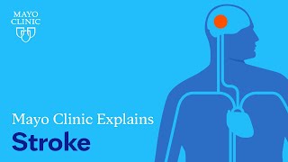 Mayo Clinic Explains Strokes [upl. by Greenebaum]