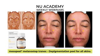 mesopeel® melanostop tranex Depigmentation peel for all skins [upl. by Groves]