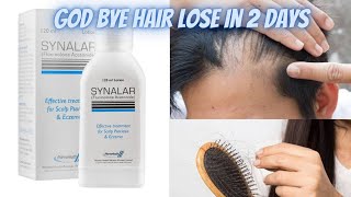 Synalar Lotion Best For Anti Hairloss Regrowth Hairs Review UrduHindi Khan Fam official [upl. by Klute]