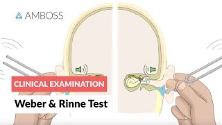 Weber and Rinne Test  Clinical Examination [upl. by Oidiple368]