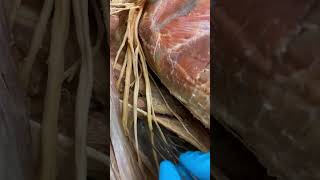 Brachial plexus anatomy [upl. by Spain677]