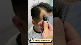 Perfect Solution to Hair Loss amp Thinning Hair  Hair Patch amp Hair Replacement  No Hair Transplant [upl. by Jeremy]