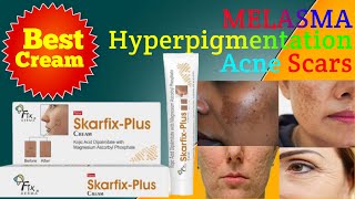 Best cream for melasmahyperpigmentationacne scars  Skarfix plus cream [upl. by Garwin]