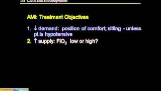 1215 ECG Management of MI [upl. by Ecirtael]