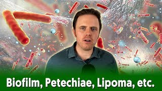 Biofilm Petechiae Lipoma etc  Dr J Q amp A [upl. by Leamiba436]