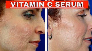 Vitamin C Serum Benefits and Effects  By Dr manoj das [upl. by Ahsinej729]