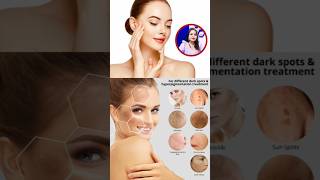 100 Effective Vaidya Glow Skin whitening cream ll No side effects ll Remove Pigmentation DarkSpots [upl. by Ahsele]