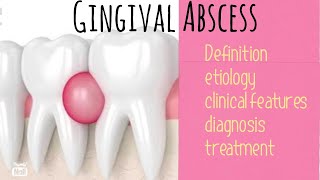 Gingival Abscess [upl. by Tai]