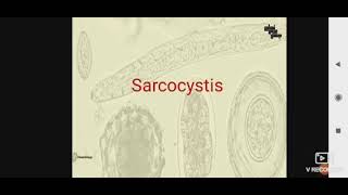 Sarcocystis para L3 [upl. by Thadeus]