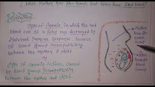 RHINCOMPATIBILITY ERYTHROBLASTOSIS FETALIS [upl. by Egni]