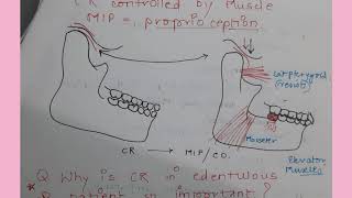 Centric jaw relation in Complete Denture NOTES Methods to record Significance [upl. by Anyalram447]