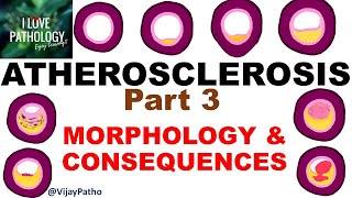 ATHEROSCLEROSIS Part 3  Morphology and consequences [upl. by Pinzler]