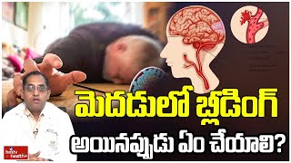 మెదడులో బ్లీడింగ్ అయినప్పుడు ఏం చేయాలి l What to do when bleeding in the brain l hmtv Health [upl. by Woodsum]