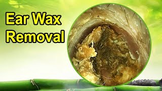 Best relaxing video earwax removal [upl. by Adnilema]