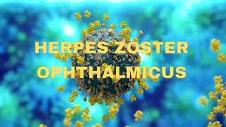 Herpes zoster ophthalmicus  OPHTHALMOLOGY  NEETPG  virus  keratitis [upl. by Joacimah736]