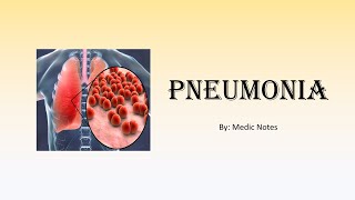 Pneumonia  bronchopneumonia lobar aspiration atypical pneumonia Legionnaires disease [upl. by Assirod]