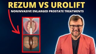 Rezum vs Urolift Minimally Invasive Treatments for Prostate Dr Kent DeLay South Carolina [upl. by Libnah120]