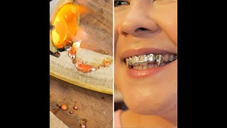 Stylish grillz to literally capture the beauty of your teeth 💎😬 shorts diy [upl. by Asaret]