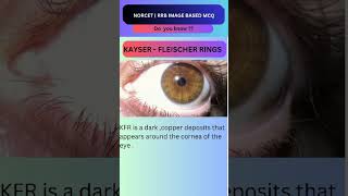 Kayser Fleischer Ring Image Based Important Question🙋 Norcet 8 ytshorts [upl. by Zinck]