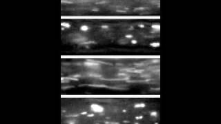 Axonal Organelle Transport in Motion [upl. by Eelyk991]