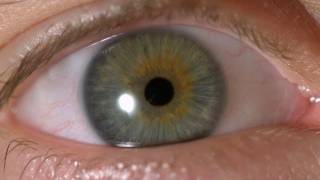 My Iris Wobbles  Eye In Slow Motion [upl. by Krista]