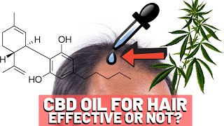 CBD Oil Hair Growth  Should You Try It [upl. by Oira19]