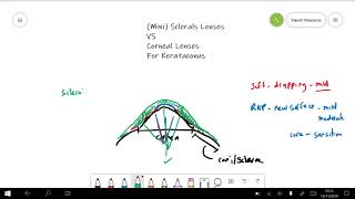 Scleral Lenses amp Corneal Lenses For Keratoconus [upl. by Aiuqet]