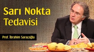 Sarı Nokta Tedavisi  Prof İbrahim Saraçoğlu [upl. by Suoilenroc]