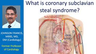 What is coronary subclavian steal syndrome [upl. by Amabelle881]