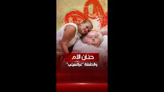 رعت ابنتها المصابة بالاستسقاء في الرأس لمدة 31 عاماً من دون أي ملل أو كلل [upl. by Ocire]